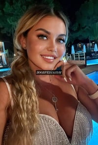 Milia