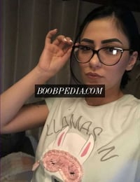 Babydoll Rebeka – photo 10