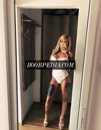 Alisson – photo 3