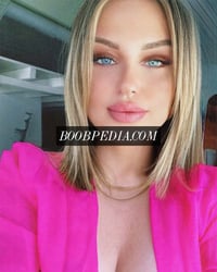 Kylie – photo 9