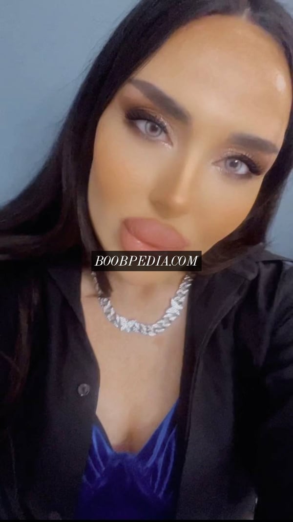 ANUELLA