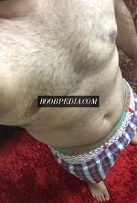 MM