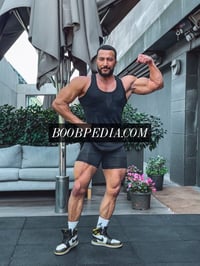Tony – photo 5