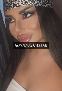 Andra – photo 20