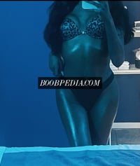 Chantelle Rose – photo 5