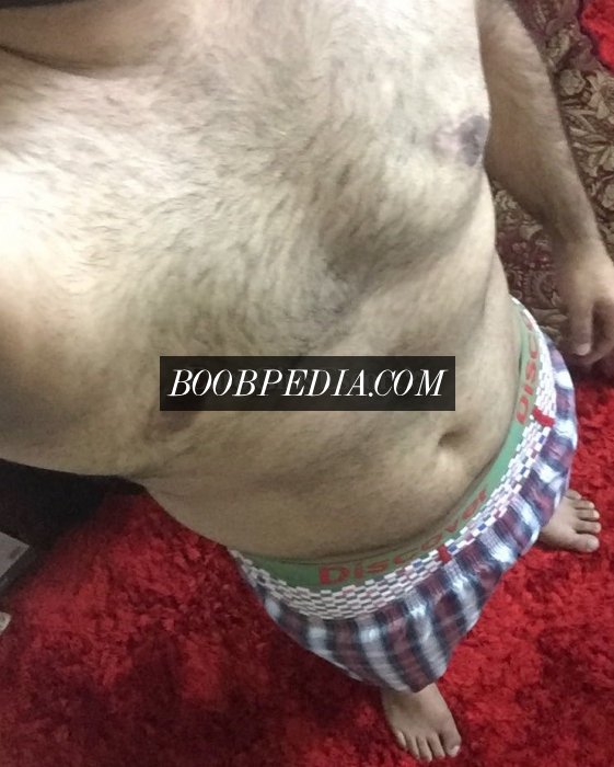 MM