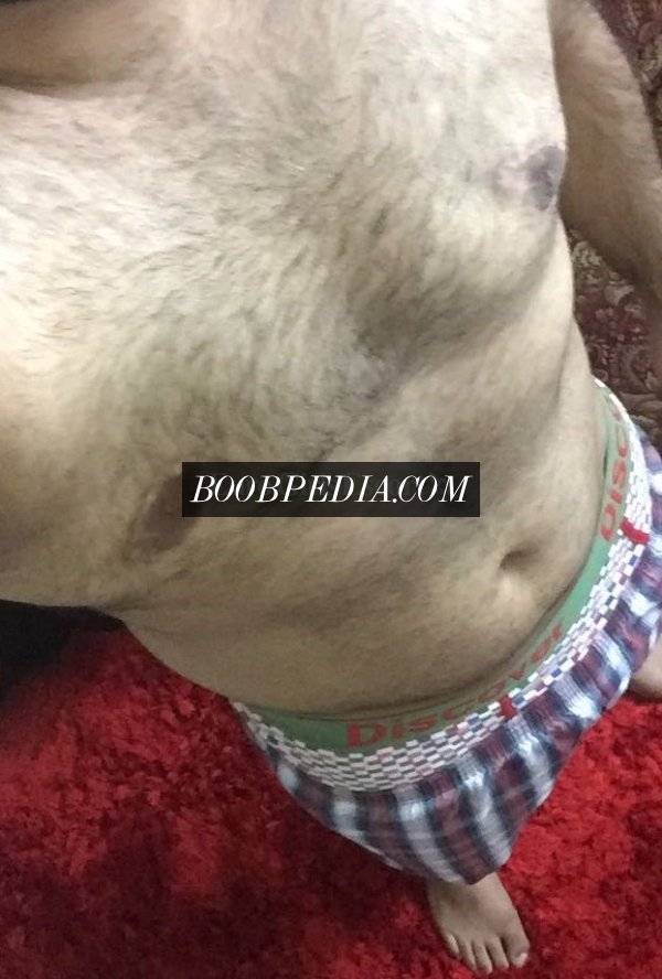 MM