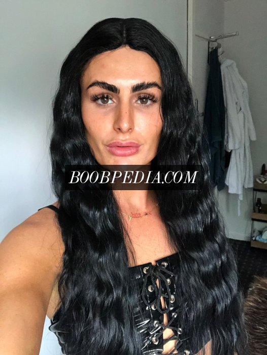 Ts Rachael