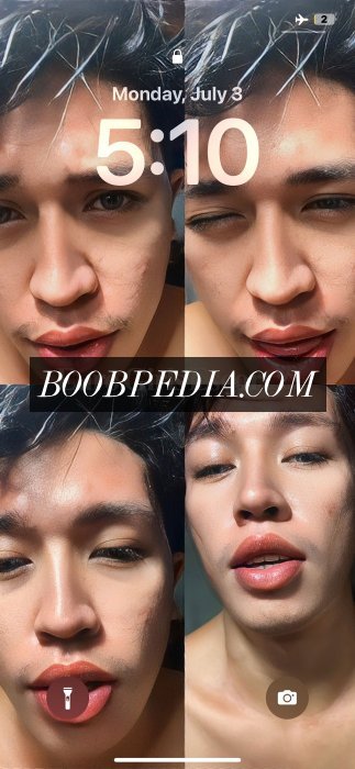 Nicsfoxph