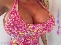 Implants at 2000cc