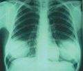 Thumbnail for version as of 04:15, 27 April 2008